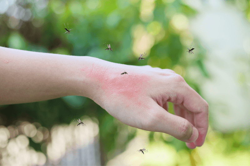 a hand with mosquitoes on it