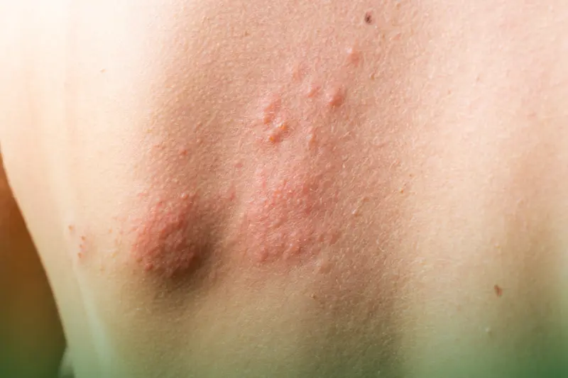 Allergic Reactions or Health Issues itchy skin due to irritation or allergic reactions