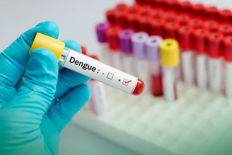 Dengue Positive a dengue positive result